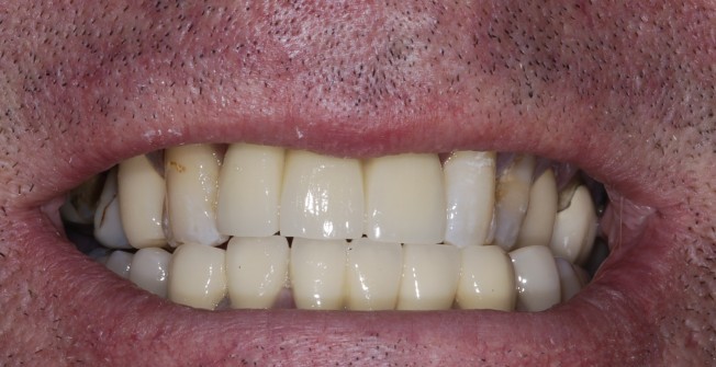 Expert Smile Enhancement in Weston